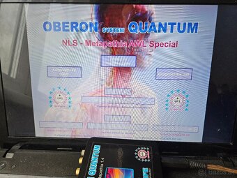 Oberon Quantum diagnostický biorezonančný prístroj - 3