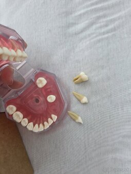 Model zubov vyberateľné zuby - 3