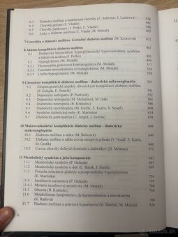 Diabetes mellitus - 3