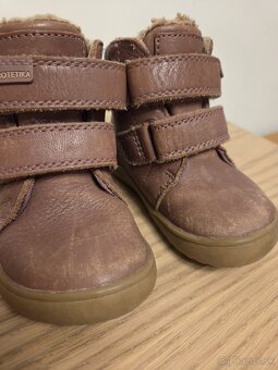 protetika zimne topanky 21 - 3