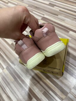 Protetika barefoot - 3