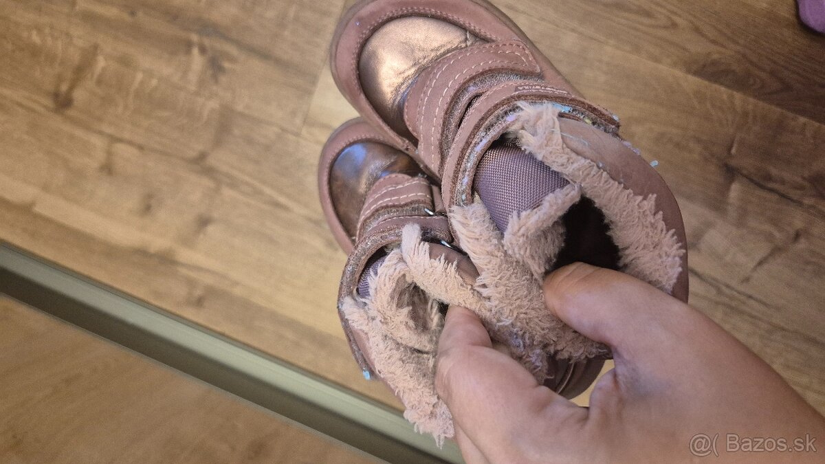 protetika zimne 27 - 4