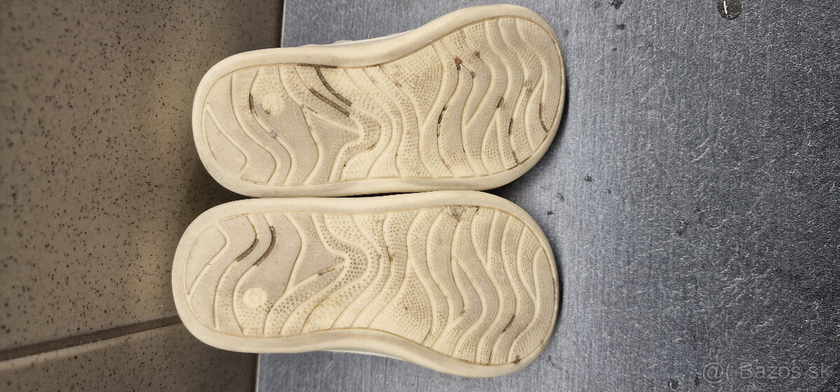 predam dievcenske topanky protetika barefoot - 4