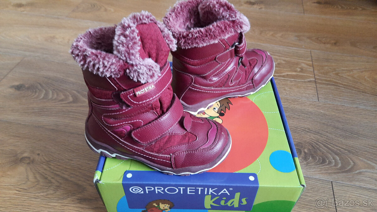 Dievcenske cizmicky protetika - 4