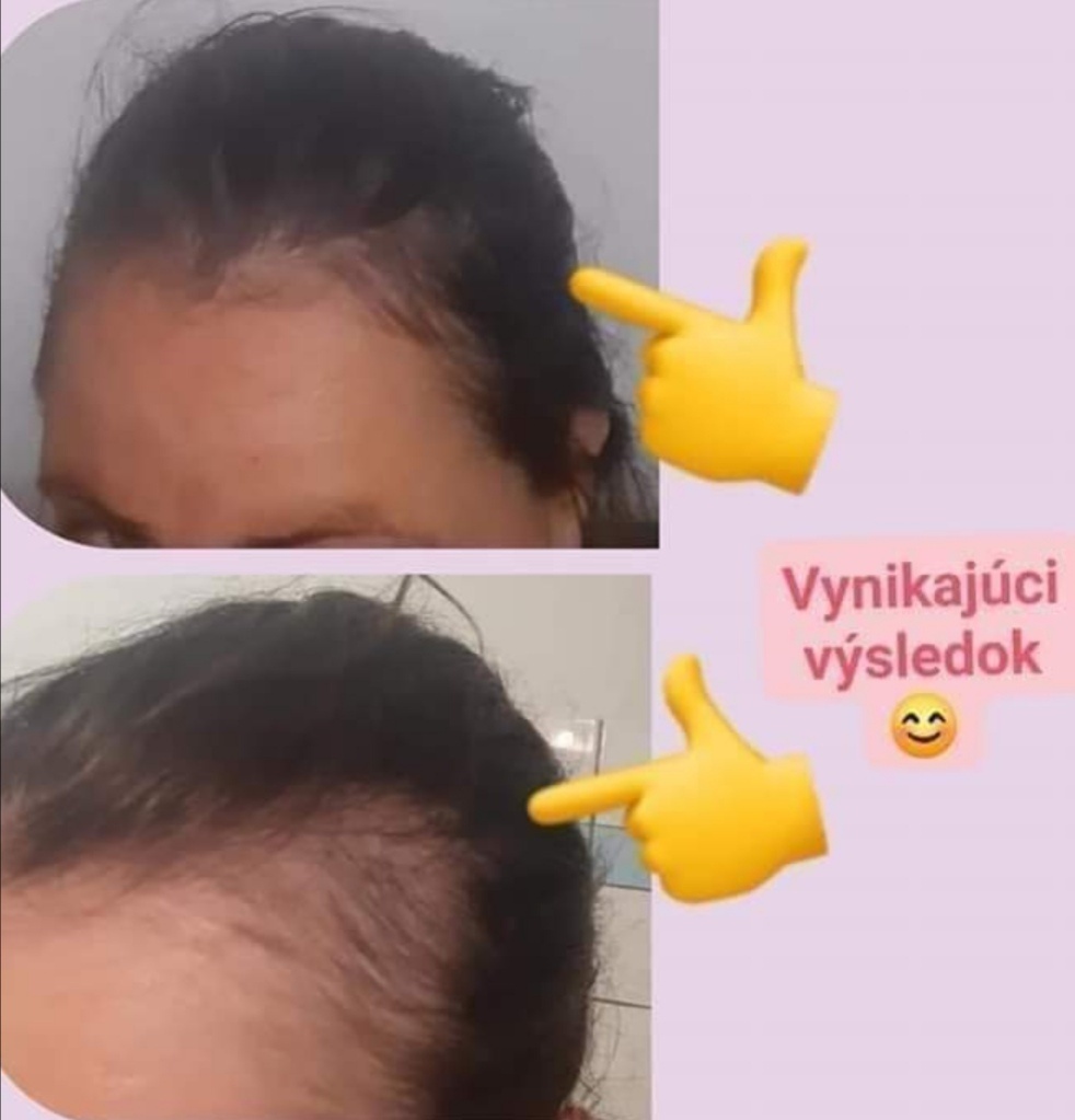 Cesnakový šampón 2kusy 13e - 4