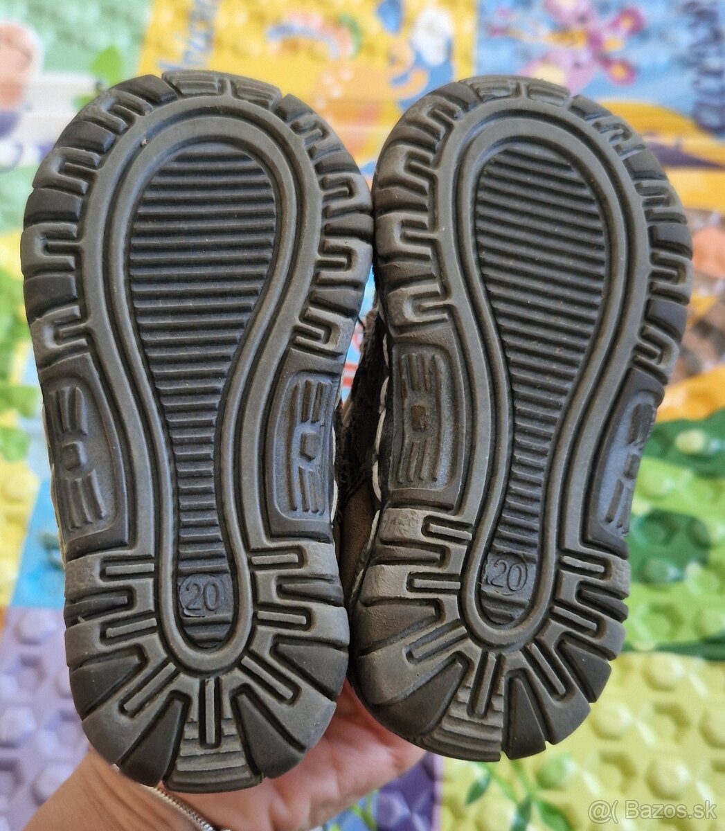 Topanky Protetika - 4