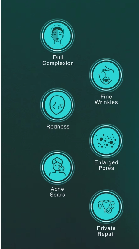 Thulium Laser F2 FX - L01 - 4