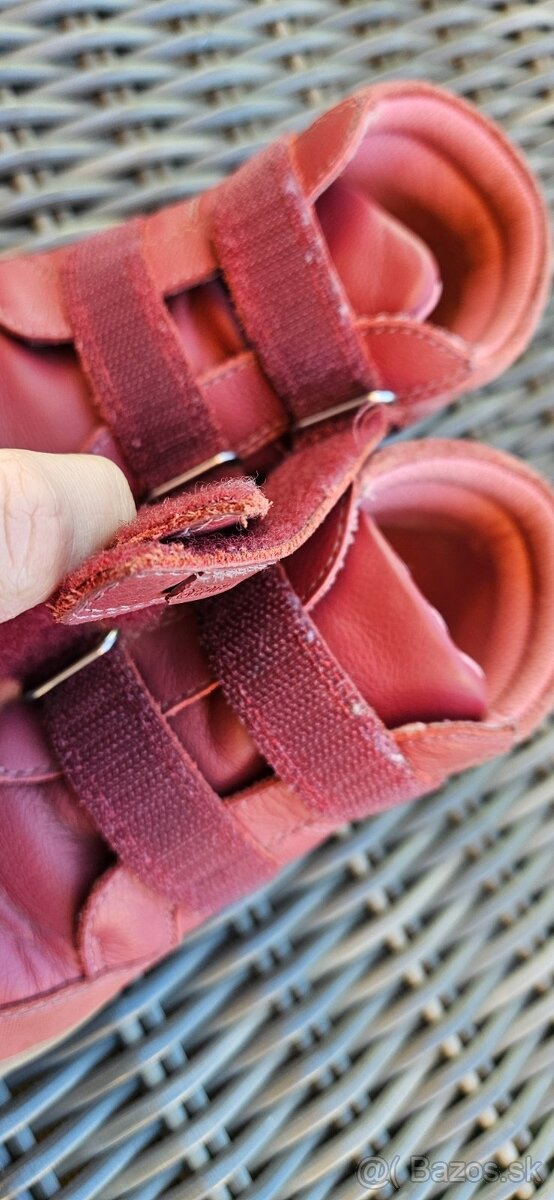 Protetika celorocky v. 29 - 4