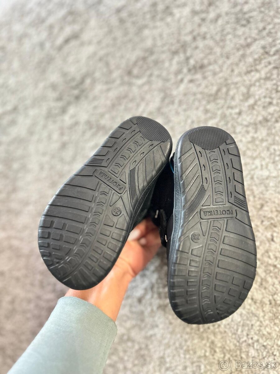 Topánočky protetika - 4