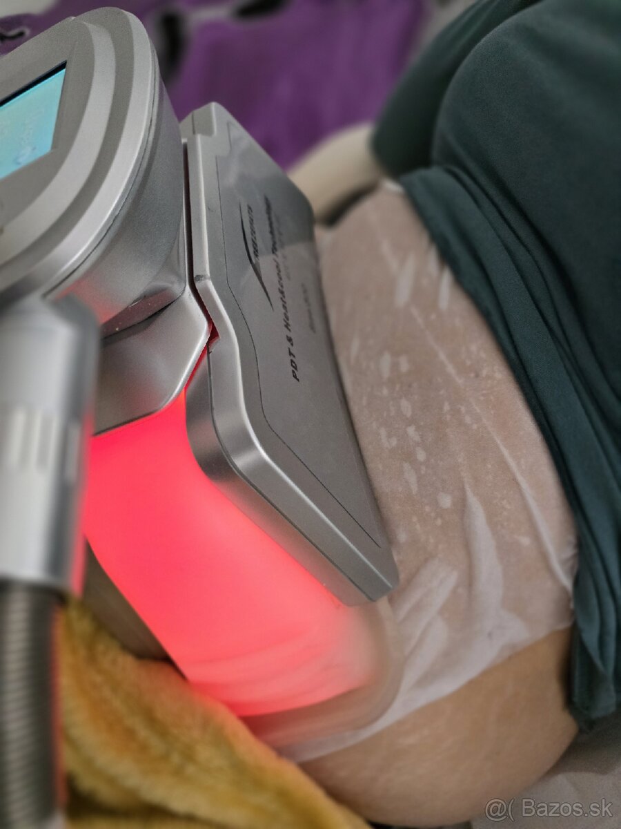 Kryolipolýzny prístroj - 4