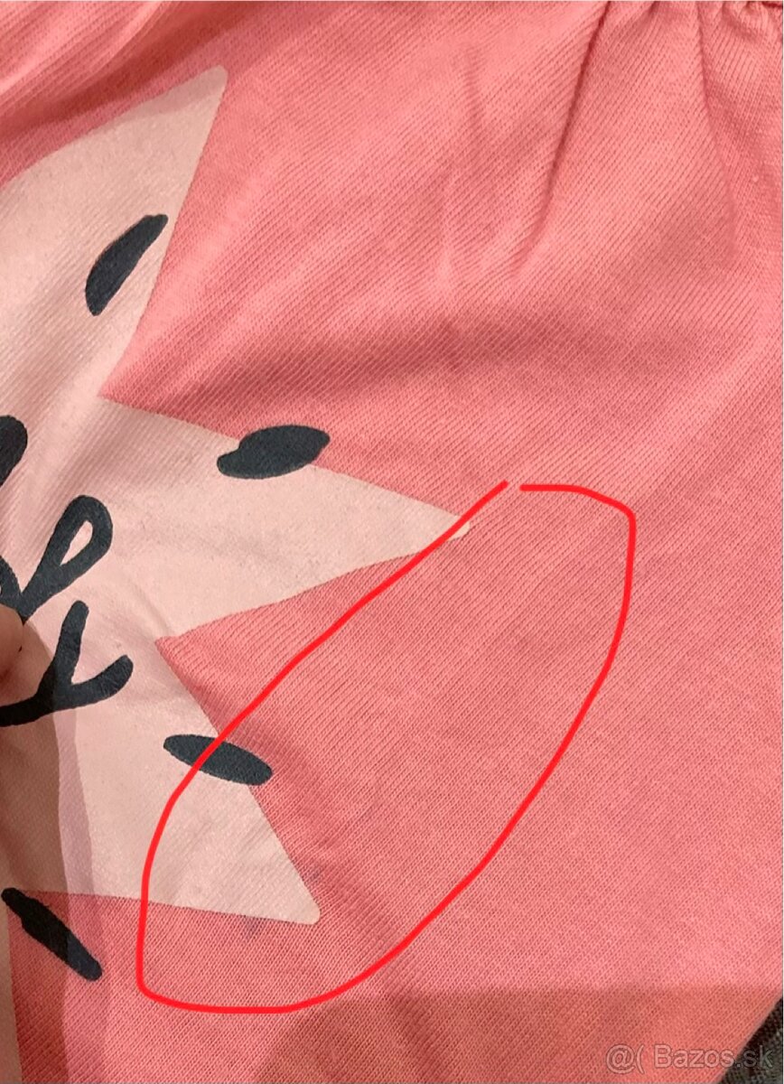 3 x letný overal + body so sukňou - 4