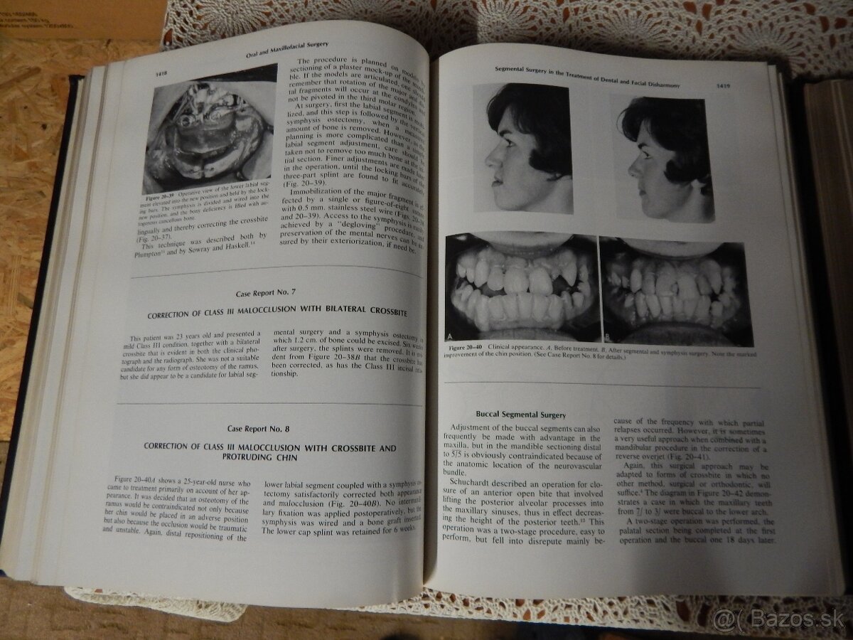 učebnice stomatologia - 4