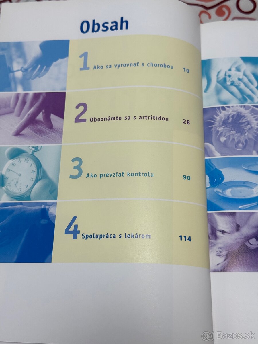 Ako zvládnuť artritídu - 4