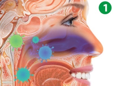 Stop chrápaniu a alergiám - 4