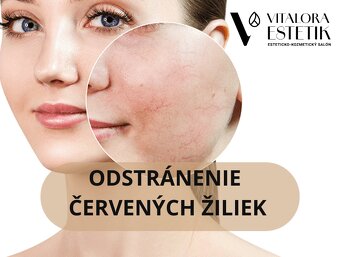 dermatoestetika - 4