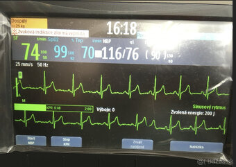 AED, Profesionálny defibrilátor PHILIPS - NOVÝ - 4