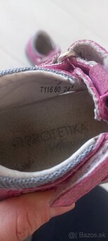 Protetika sandalky - 4