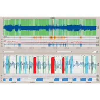 ResMed ApneaLink Plus - Domáce diagnostické zariadenie - 4
