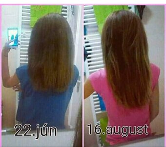 Cesnakový šampón 13e za 2ks - 4