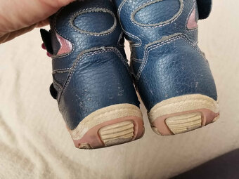 Protetika Mira Navy č. 25 - 4