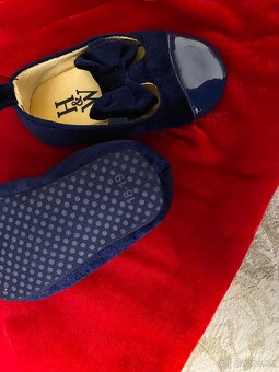 Šaty dievča vel. 86, topánky vel.18-19 - 4