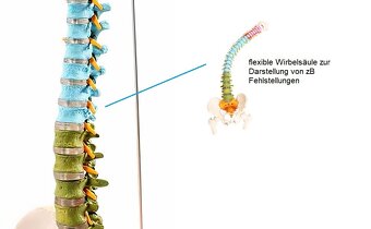 Model chrbtice s panvou Cranstein A-339 - 4