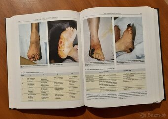 Princípy chirurgie I – III + Detská chirurgia (KOMPLET) - 4