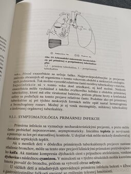 Predám knihu Tuberkulóza, Anton Bajan - 4