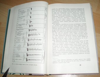 Rez a tvarovanie ovocných drevín - 4