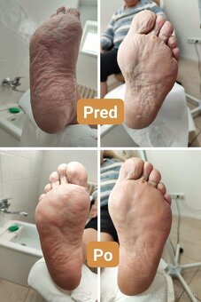 Kozmetika, pedikúra - 4