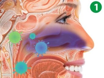 Stop chrápaniu a alergiám - 4