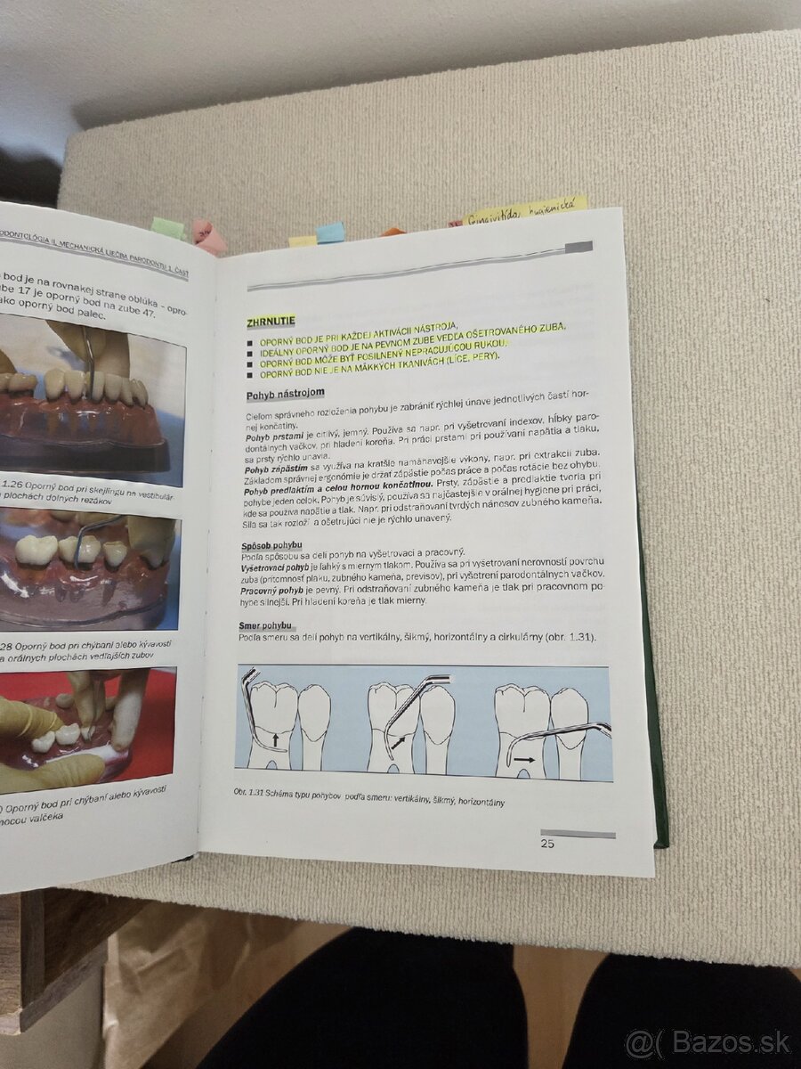 Parodontológia 2 II - 5