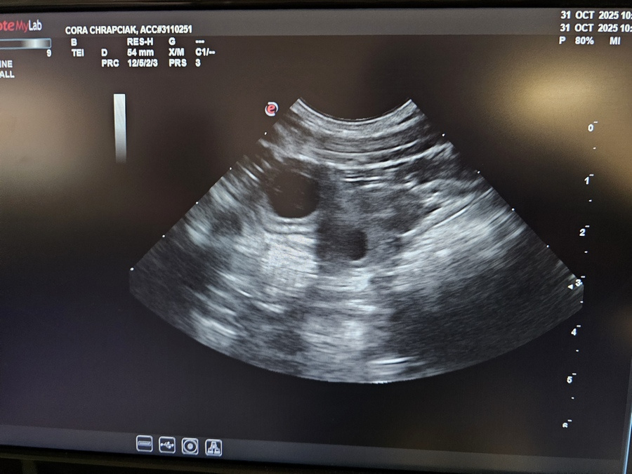 Tibetská doga šteniatka s PP po špičkových rodičoch - 5