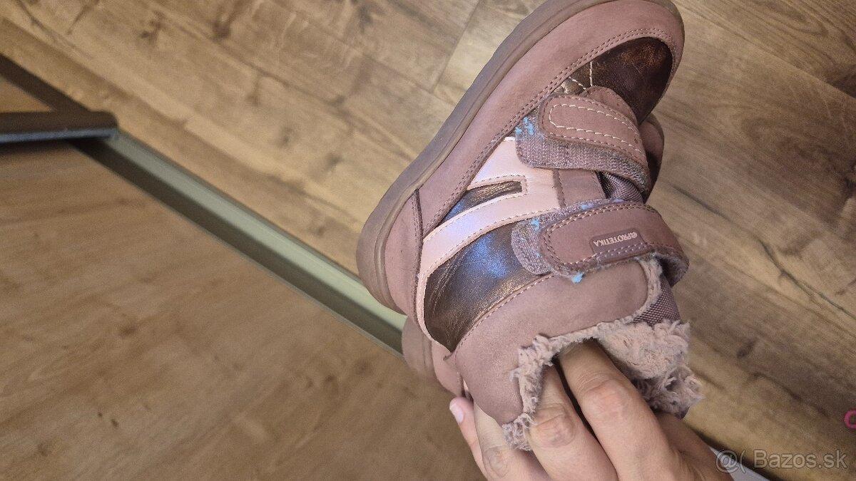 protetika zimne 27 - 5