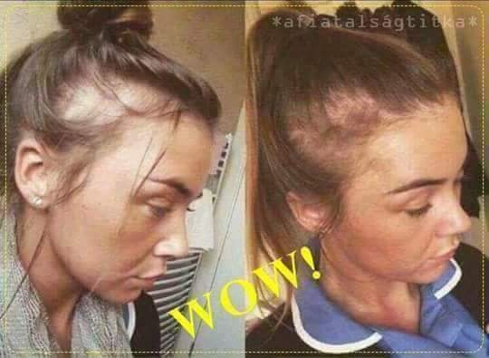 Cesnakový šampón 13e za 2ks - 5