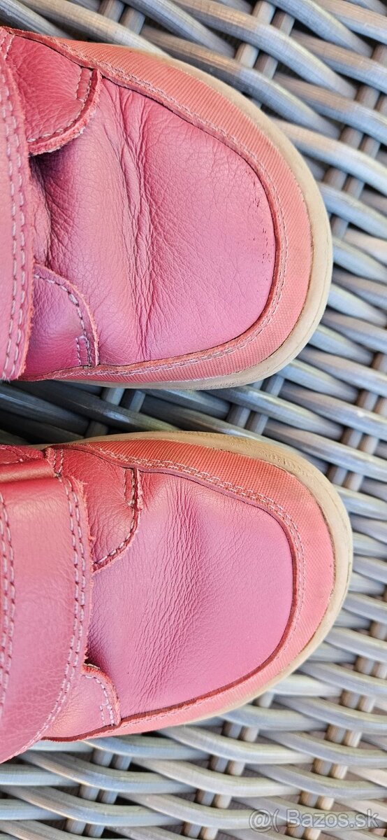 Protetika celorocky v. 29 - 5