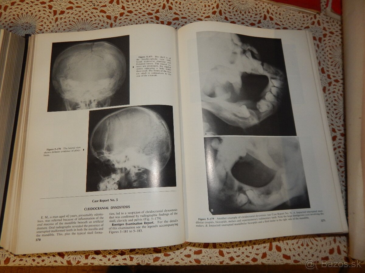 učebnice stomatologia - 5