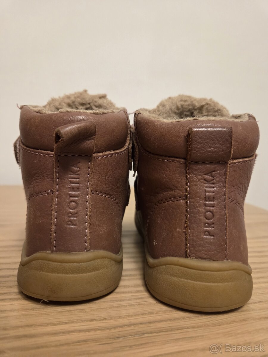 protetika zimne topanky 21 - 5