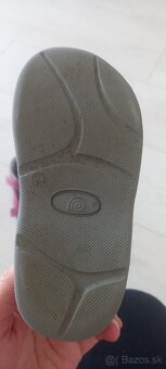 Protetika sandalky - 5