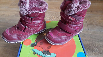 Dievcenske cizmicky protetika - 5