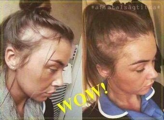 Cesnakový šampón 13e za 2ks - 5