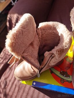 Protetika čižmičky - 5