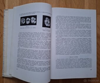 Zubna protetika - 5