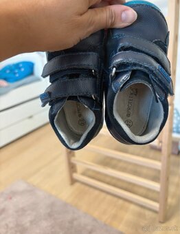 Prechodne celorocne barefoot protetika topanky - 5