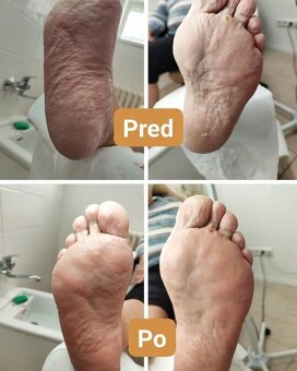 Kozmetika, pedikúra - 5