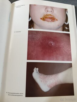 Predám knihu Dermato/venerológia - 5