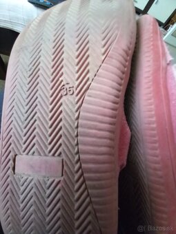 Predám dievčenské topánky č. 35 Protetika - 5