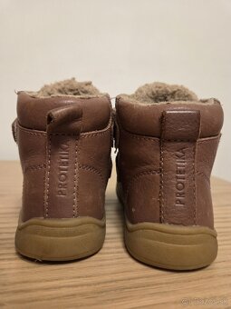 protetika zimne topanky 21 - 5