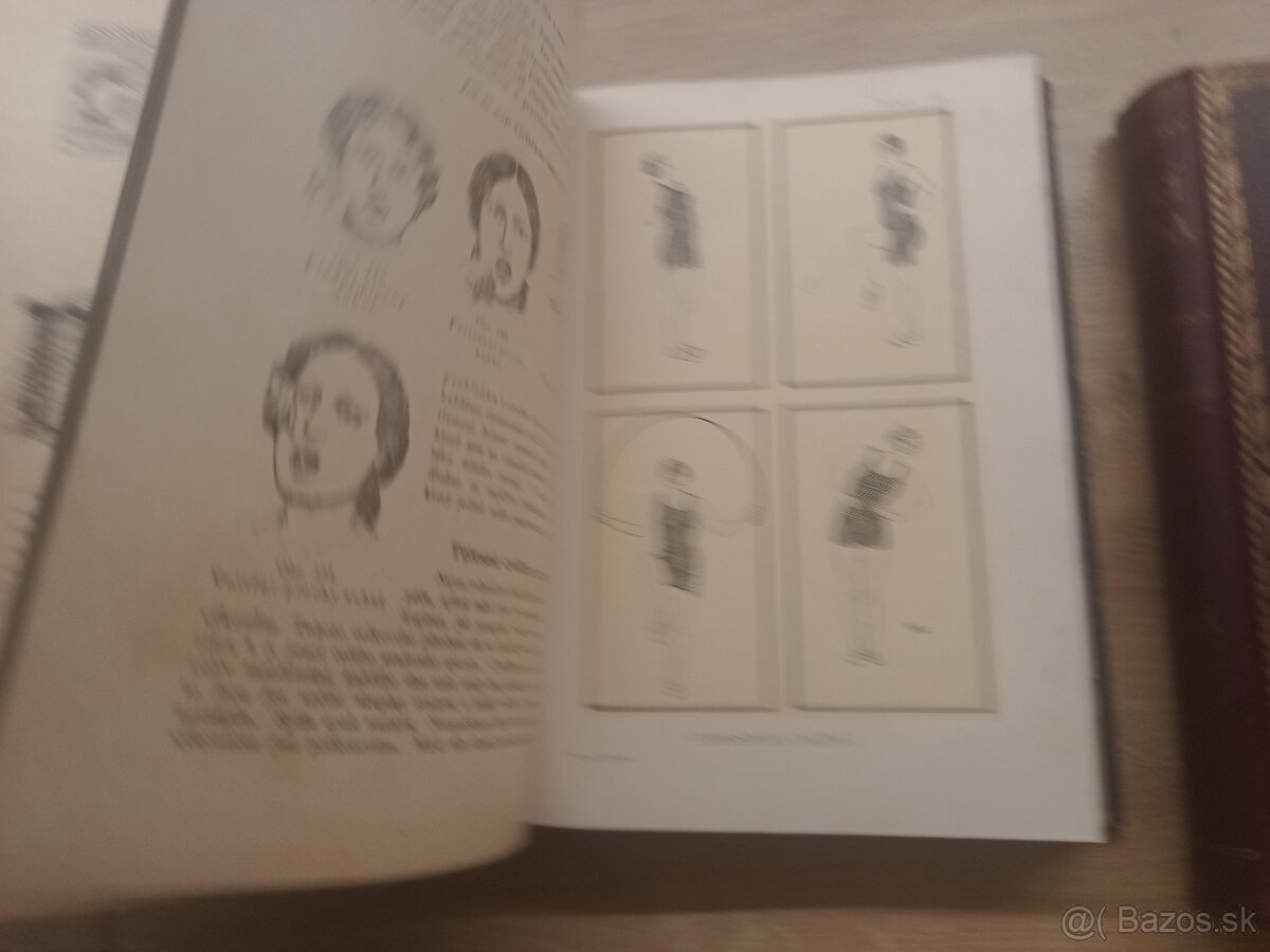 Jenny Springerová: Domáci lekárka I.,II., 1925 + rozkladacie - 6