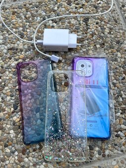 Xiaomi Mi 11 - 6